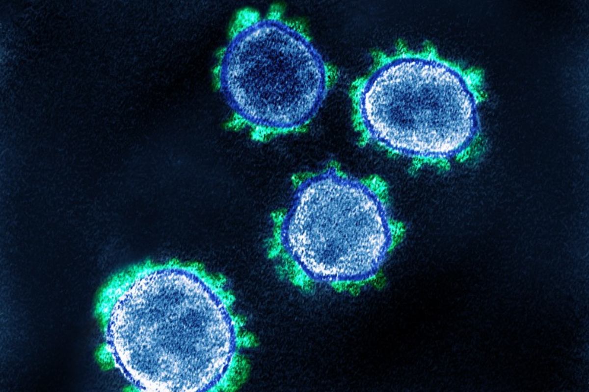 SARS-CoV-2 captado en los laboratorios de los NIH estadounidenses.